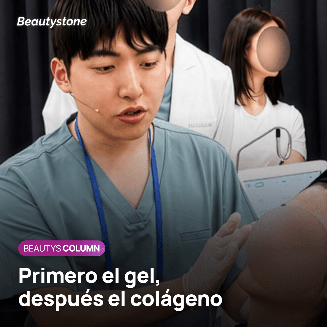 Duración de Radiesse en la sien por la acción de la CaHA