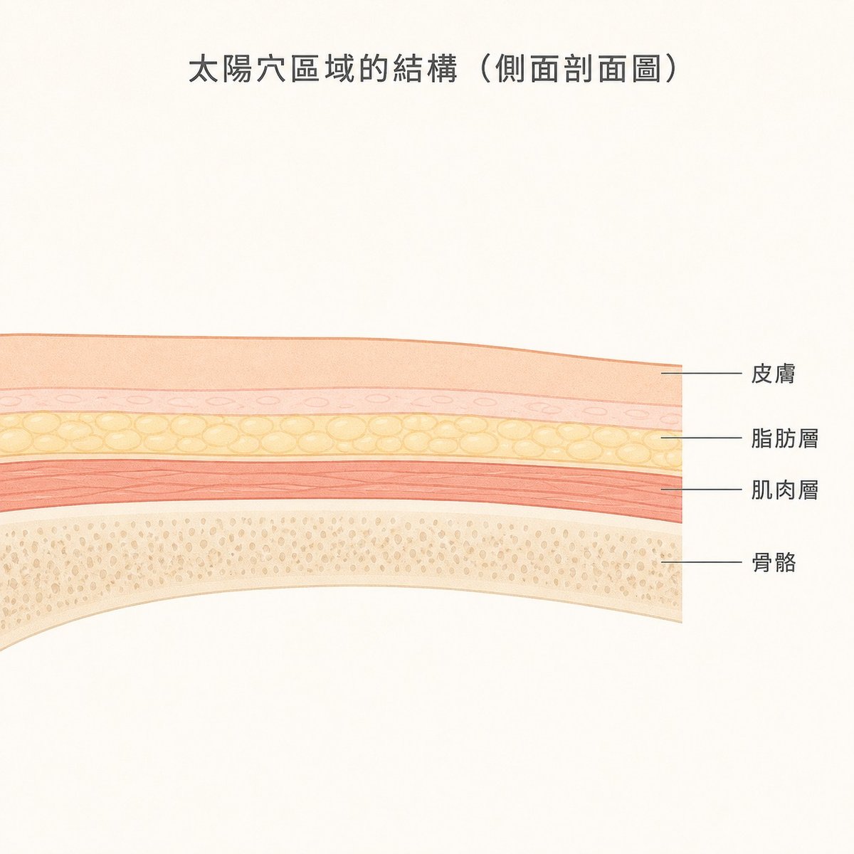 太陽穴部位斷面圖，顯示皮膚、脂肪、肌肉與骨骼一起變薄
