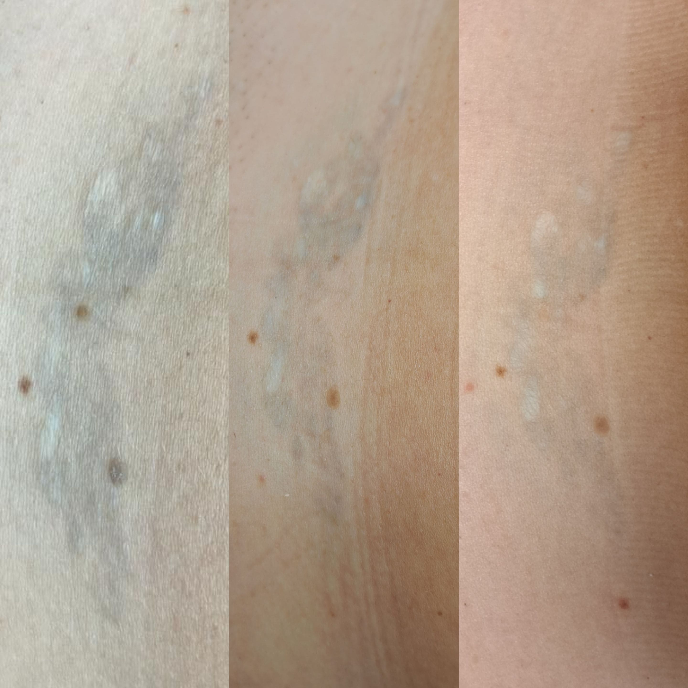 Neutralizacja makijazÌu_permanentnrgo_szczecin_leszczenko_pmu_laserowe_usuwanie