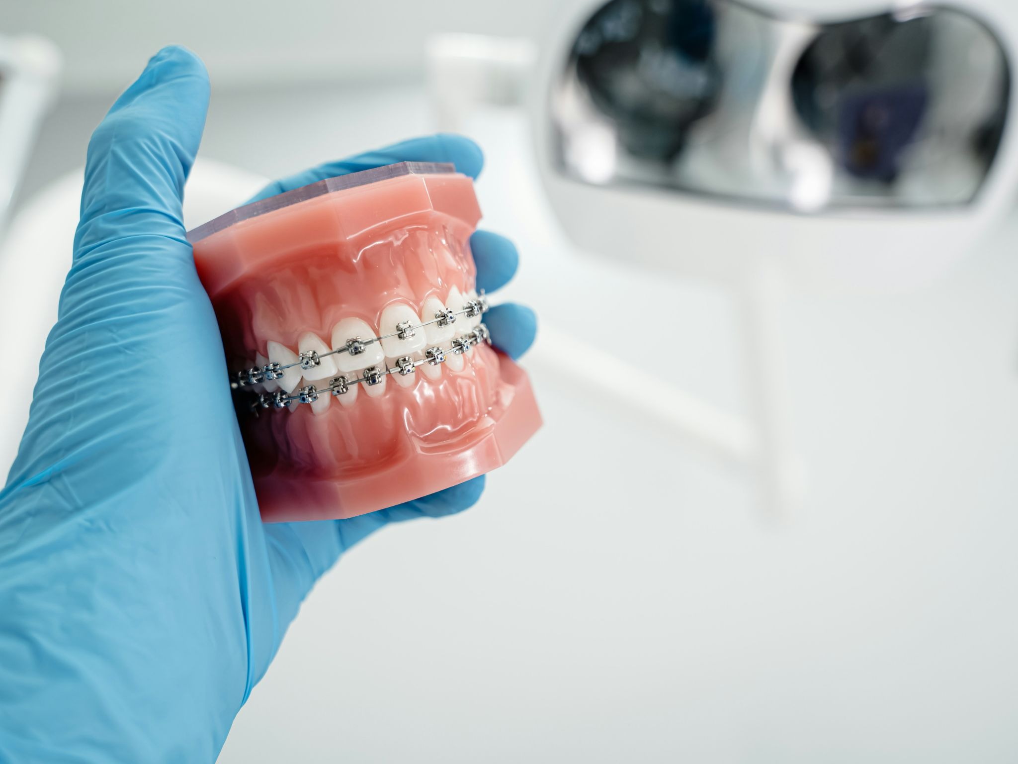How to Choose Between Metal Vs Ceramic Braces&nbsp;