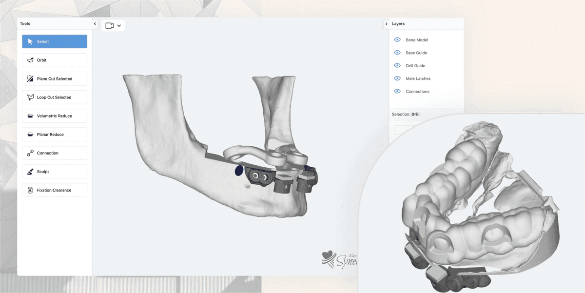 A digital anatomical illustration of a human jaw, showing detailed skeletal structure from different angles.
