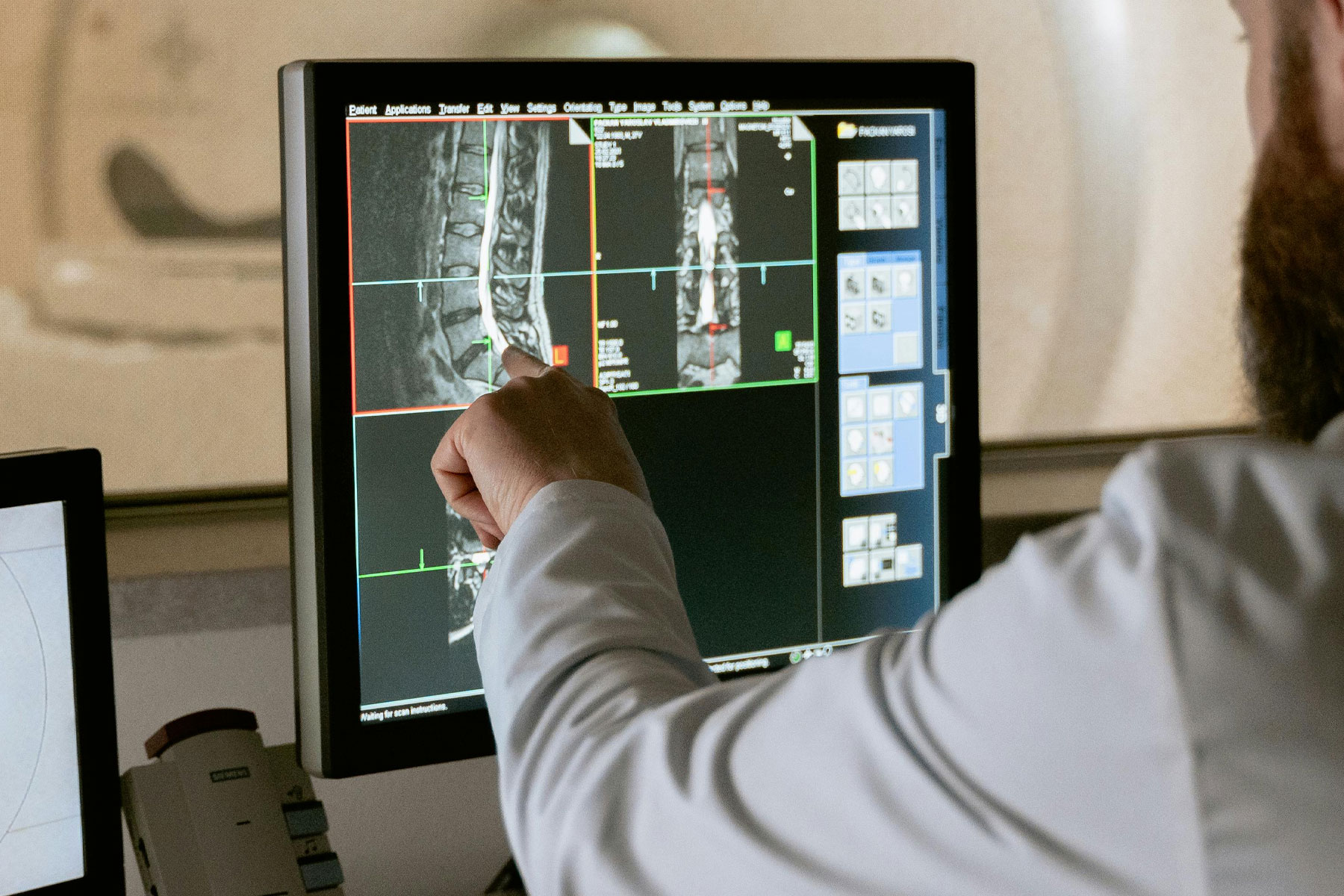 Radiologist analyzing spinal MRI images on a clinical imaging workstation