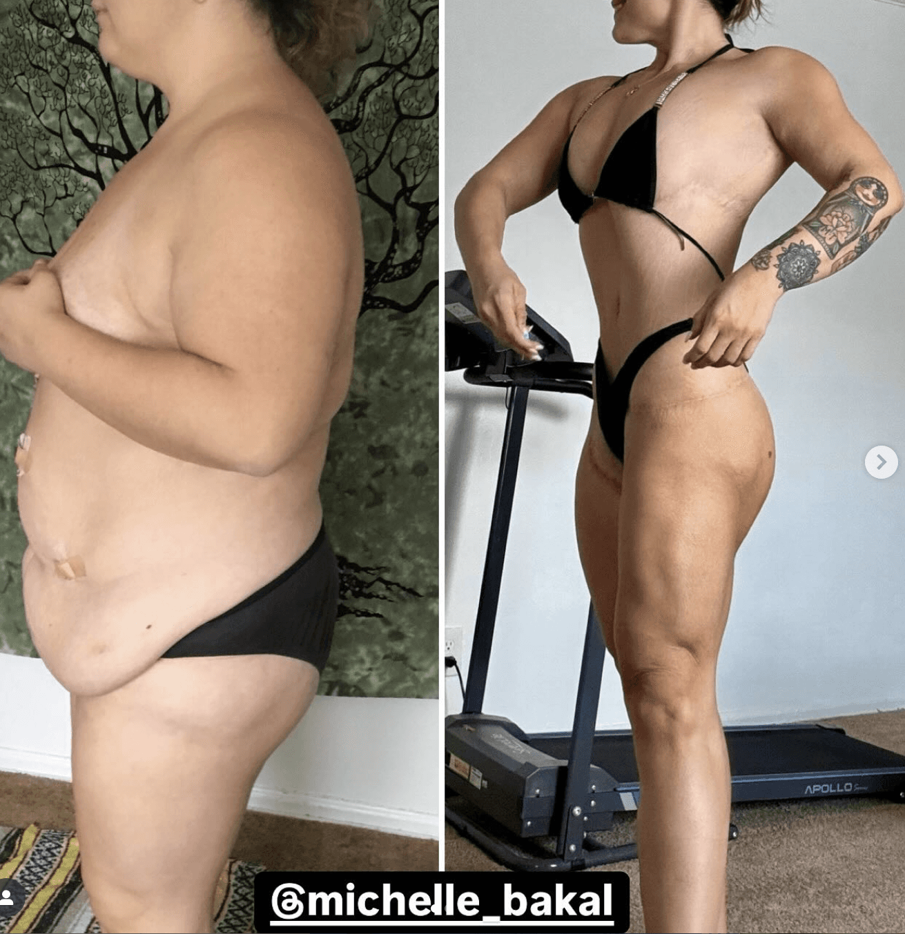 Before and after of surgery image