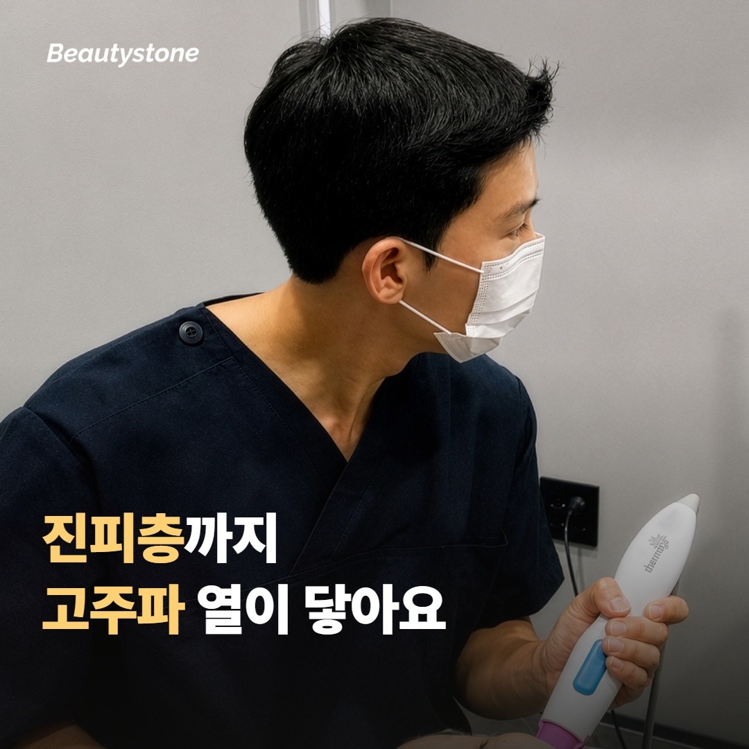 아이 써마지는 눈가 피부 어디에 작용하나요?