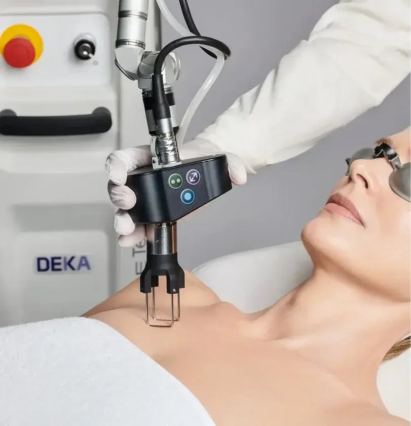 Patient receiving DEKA laser skin treatment on chest.