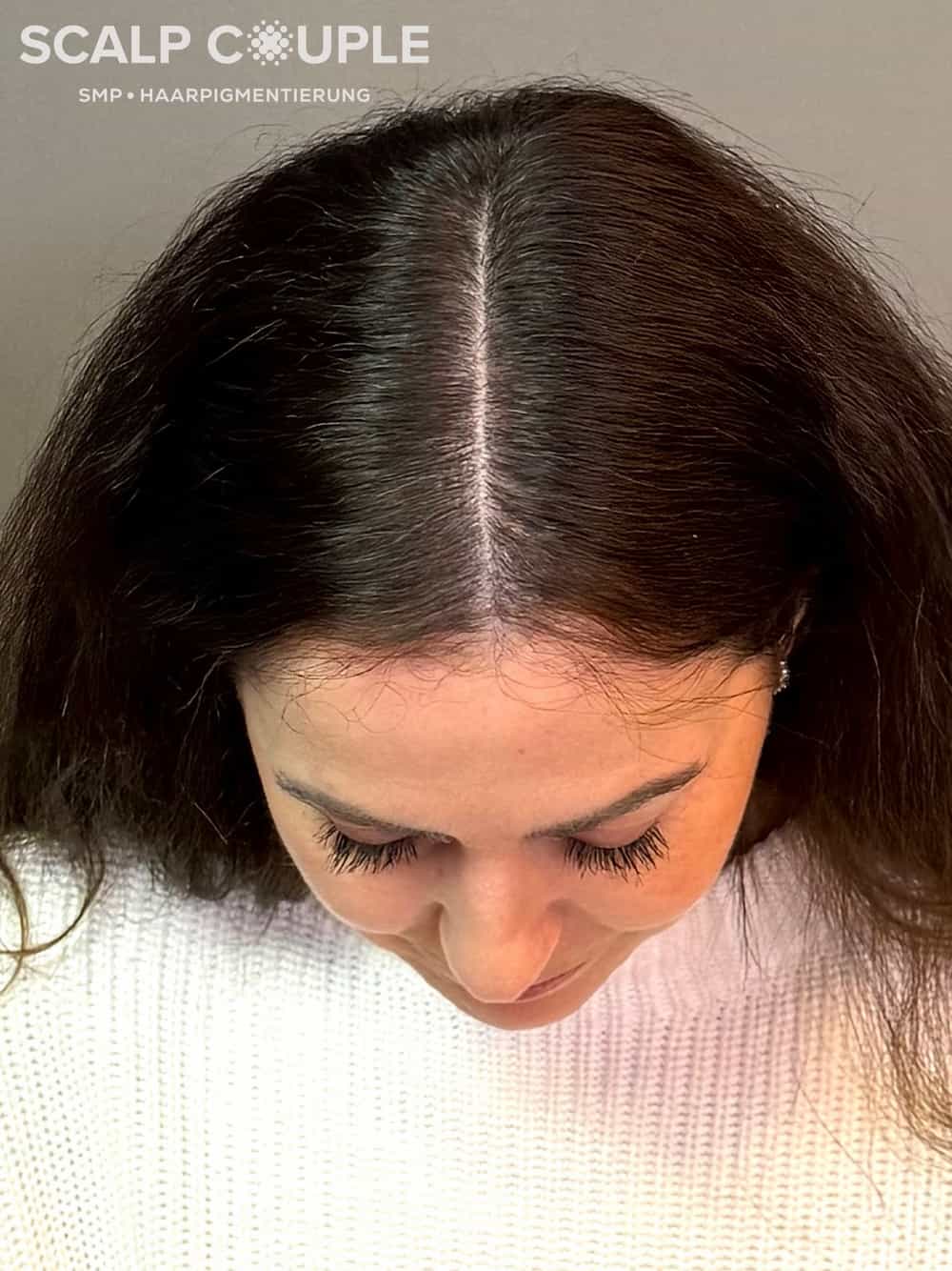 Haarpigmentierung Frau Nachher | Scalp Couple