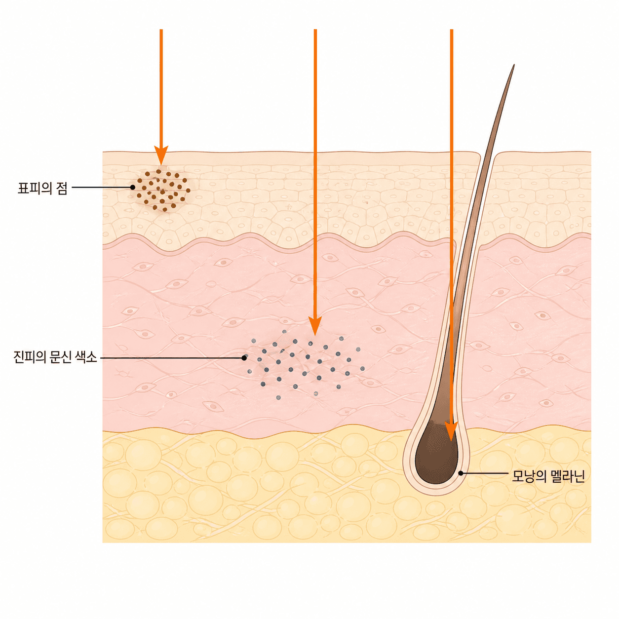 세 자리 모두 색소가 있지만, 깊이도 밀도도 서로 달라요.