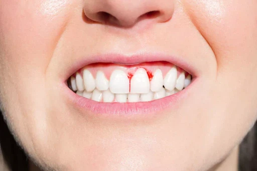 gum disease treatment service