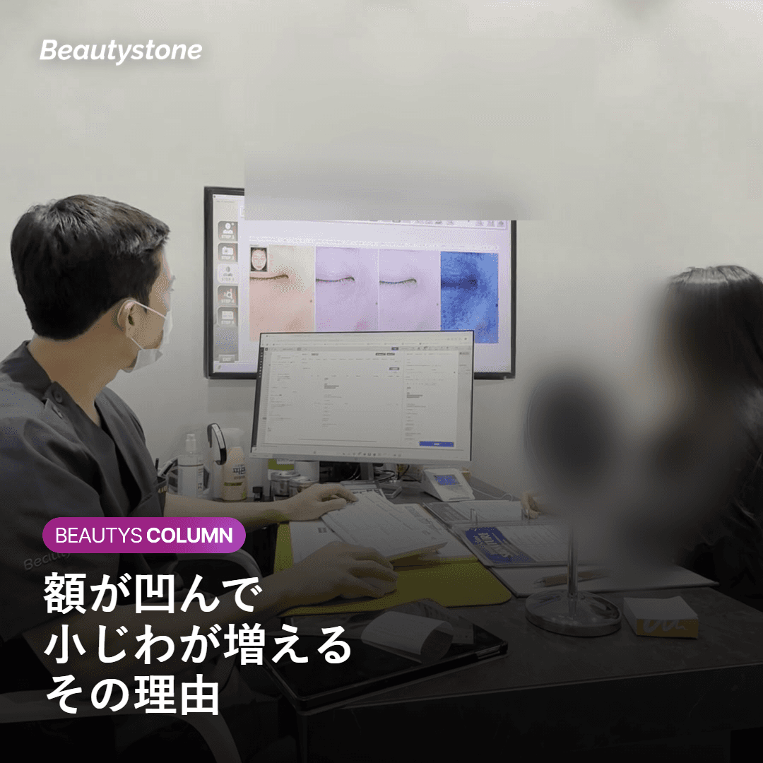 額が凹んで小じわが増える原因を示す図