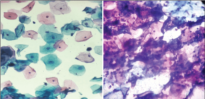 person sitting while using laptop computer and green stethoscope near