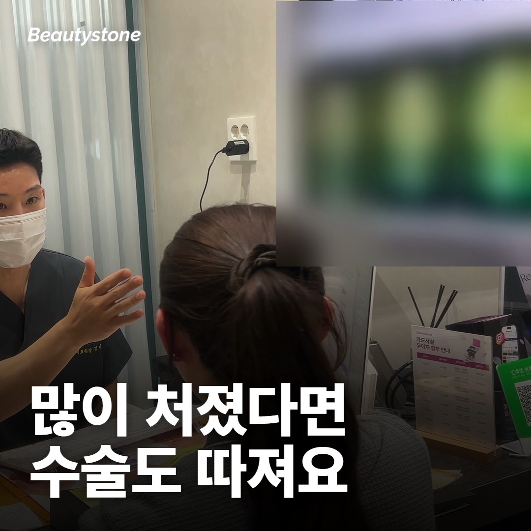 눈꺼풀 처짐이 심하면 아이 써마지로 어디까지 기대할 수 있나요?