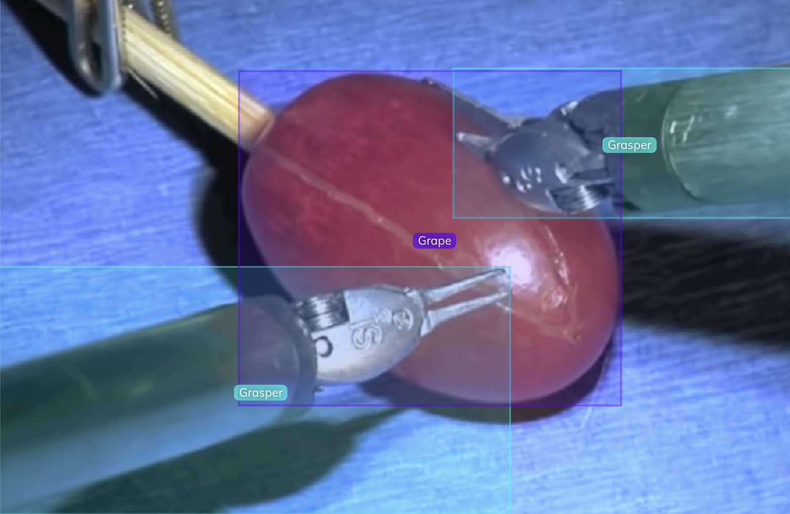 surgical video ai annotation and object detection