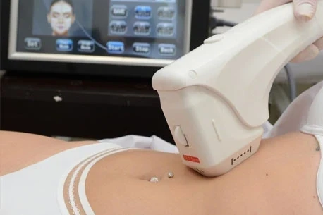 Hifu 12D Ultramatrix Corporal
