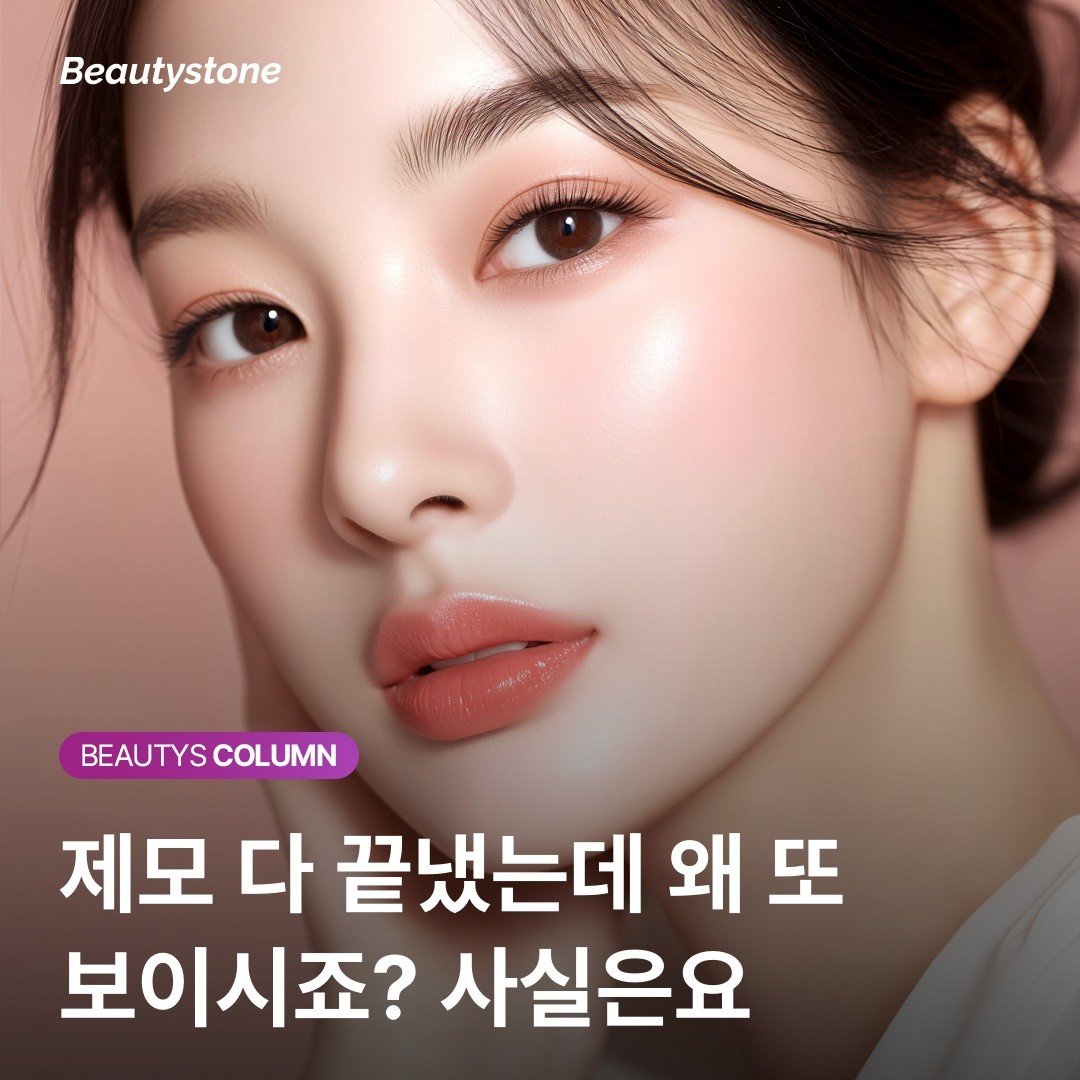 홍대 뷰티스톤 위영진 원장이 말하는 제모의 완성: 3개월 차 추가 시술의 의학적 근거