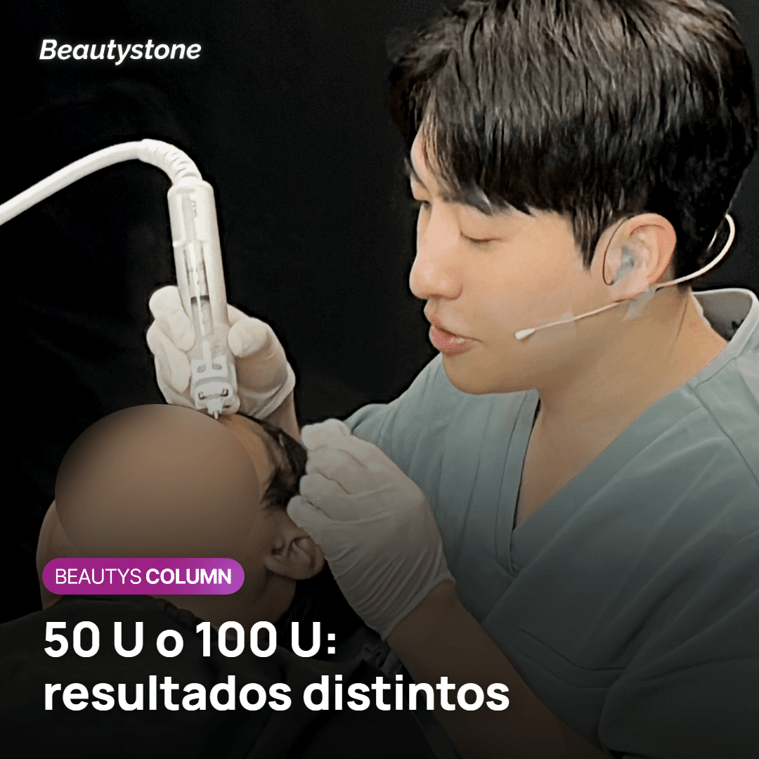 Dosis y duración del Botox de mandíbula