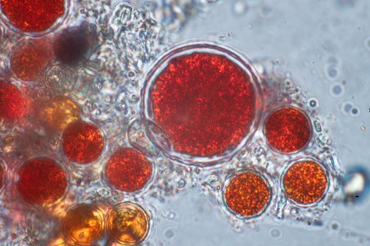 Microalgae Haematococcus pluvialis best astaxanthin natural supplement skin protection