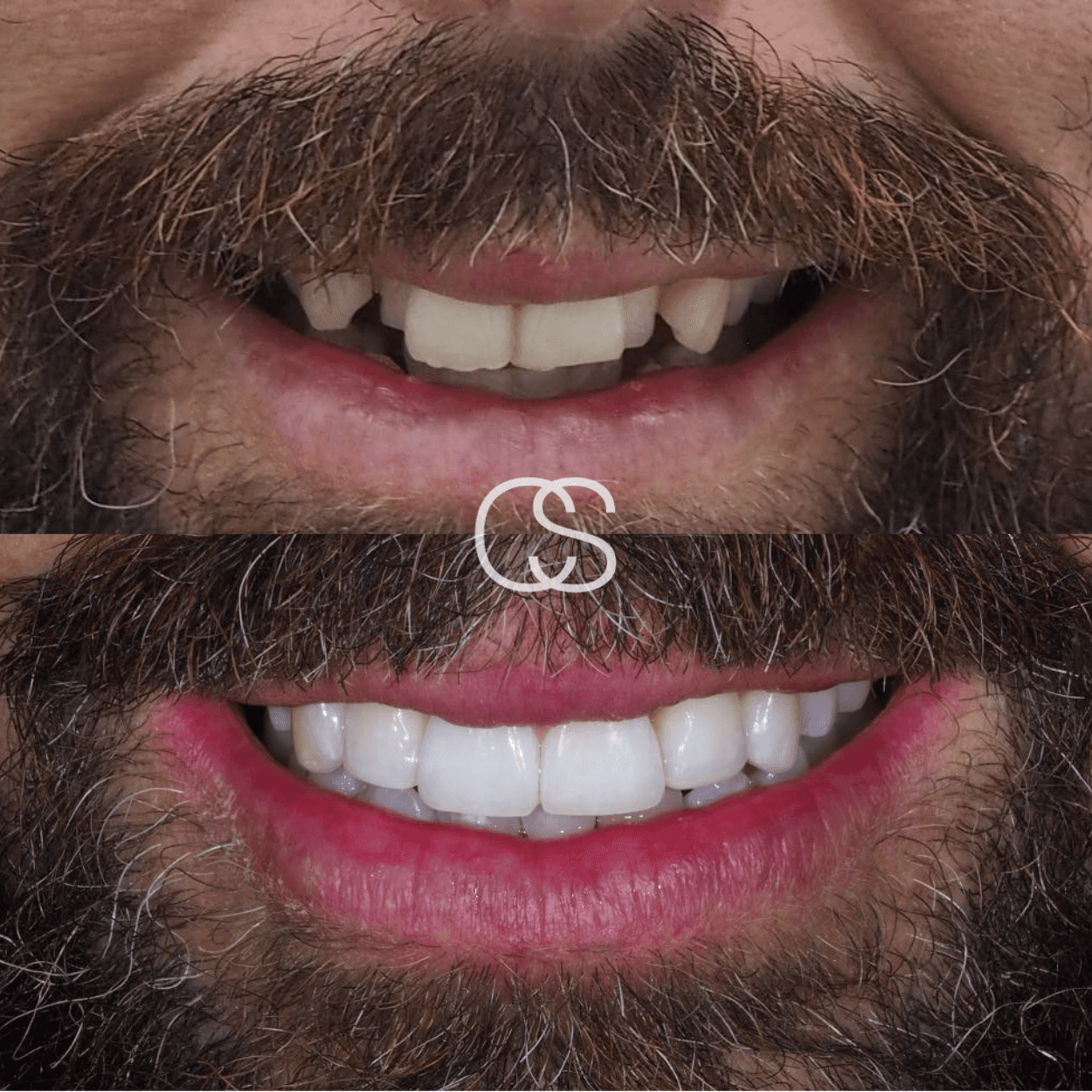 Before & After