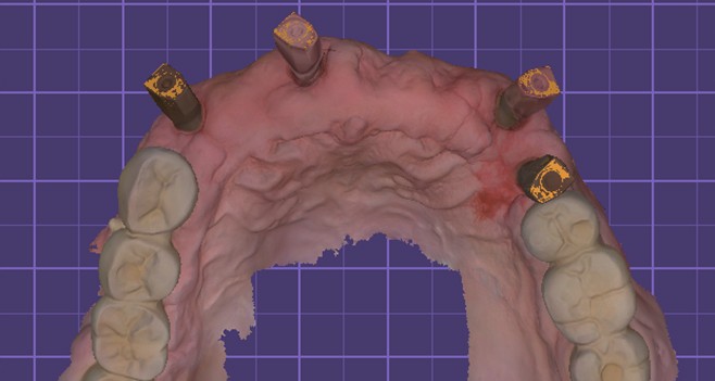아이디얼한 배열