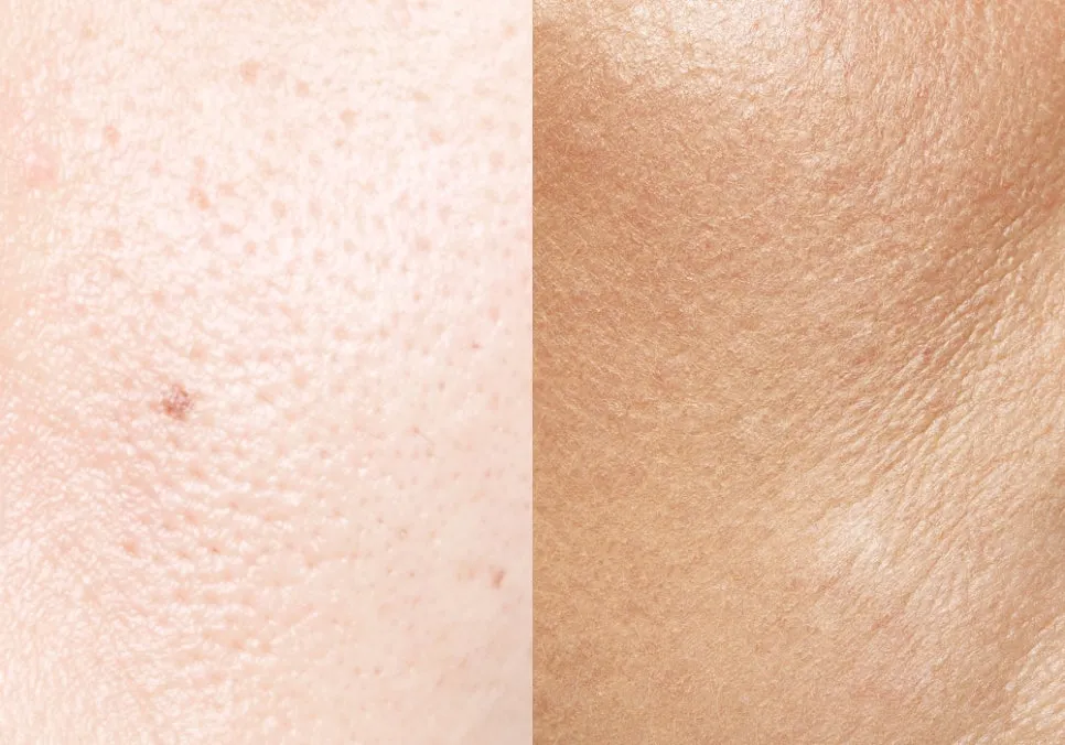 Comparison of the types of pores, vertical pores and horizontal pores