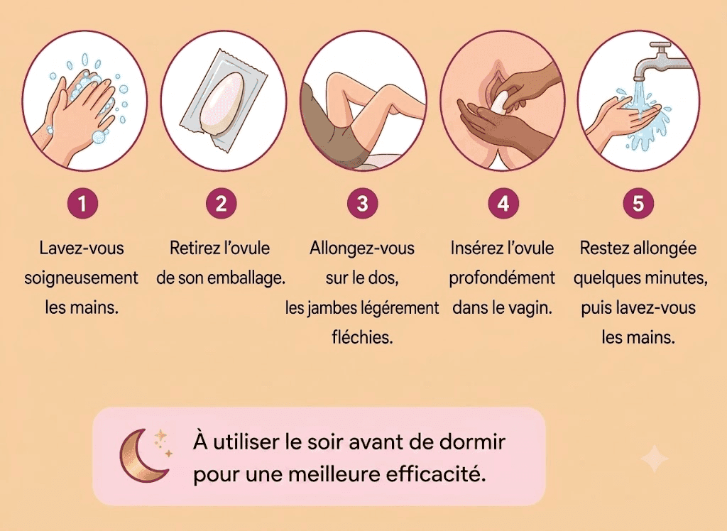 comment utiliser un ovule antifongique