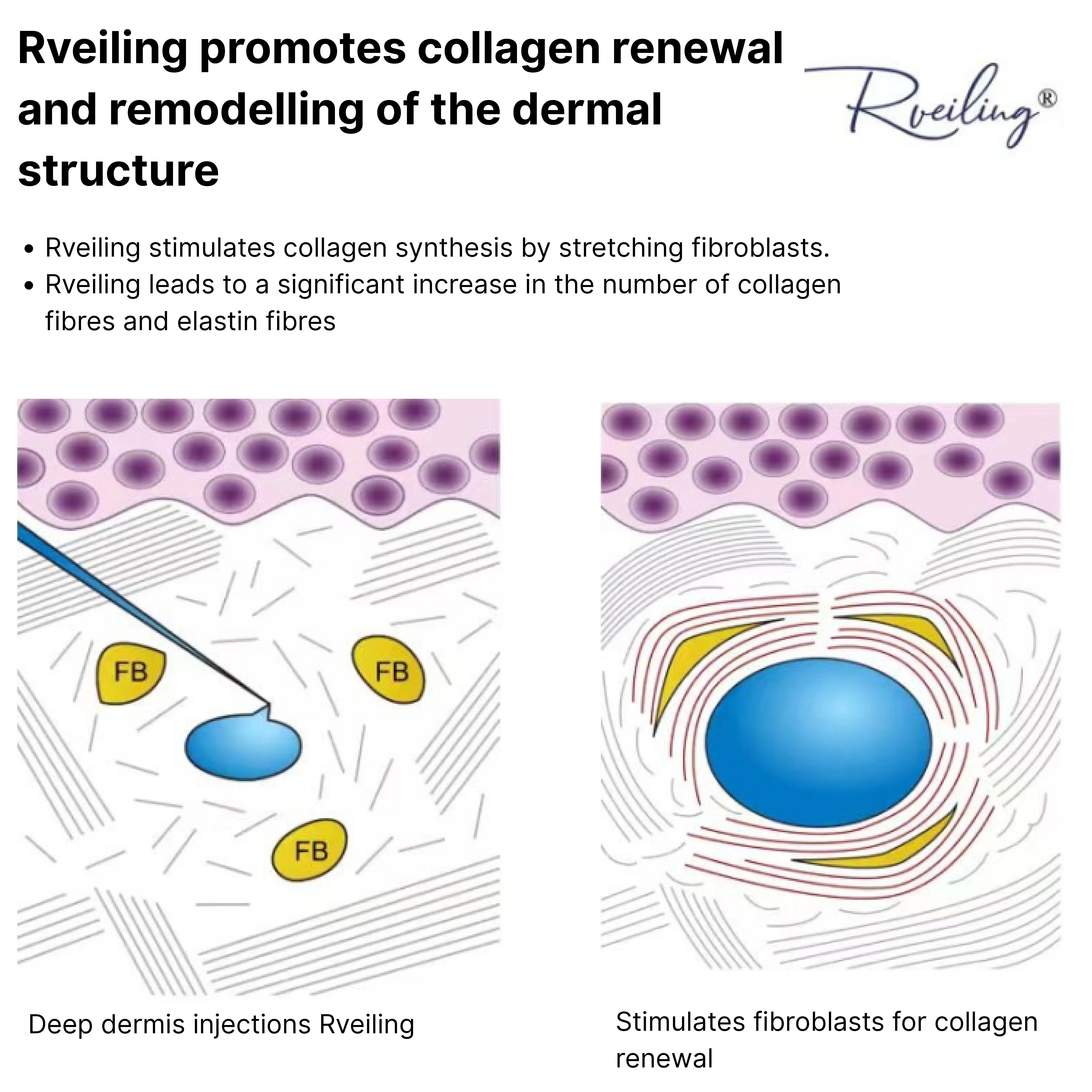 Aowita  Hyaluronic Acid Manufacturer promotes collagen renewal and remodelling of the dermal structure