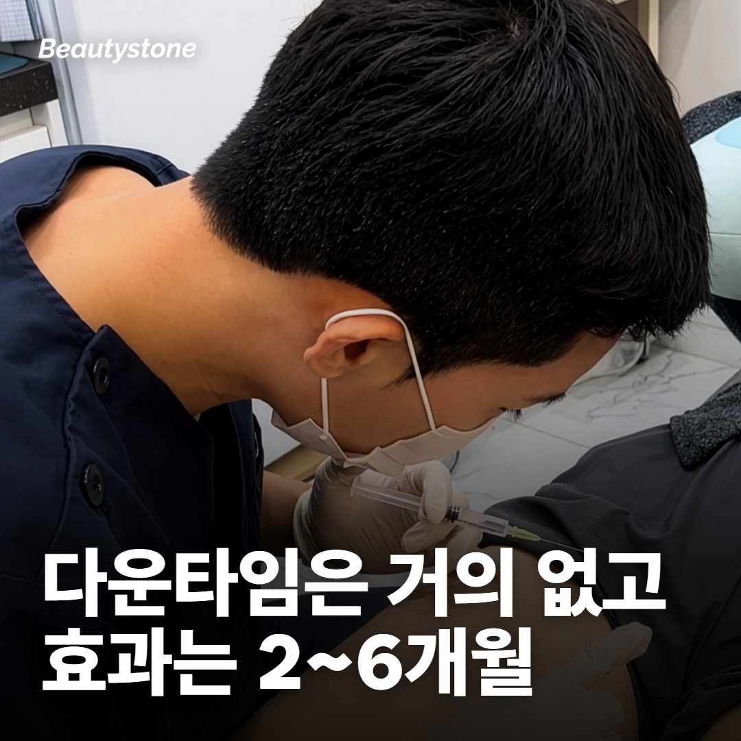 슈링크 다운타임은 거의 없어서, 일정은 효과 시점에 맞춰요