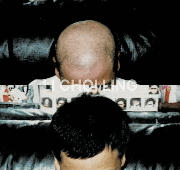 lichoiling casestudy