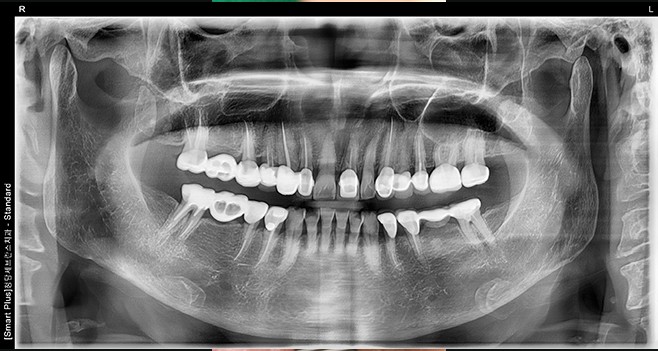 초진 파노라마
