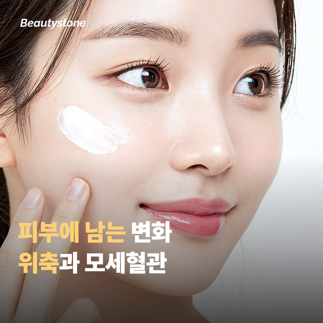 스테로이드 연고가 피부에 남기는 변화부터 알아야 해요