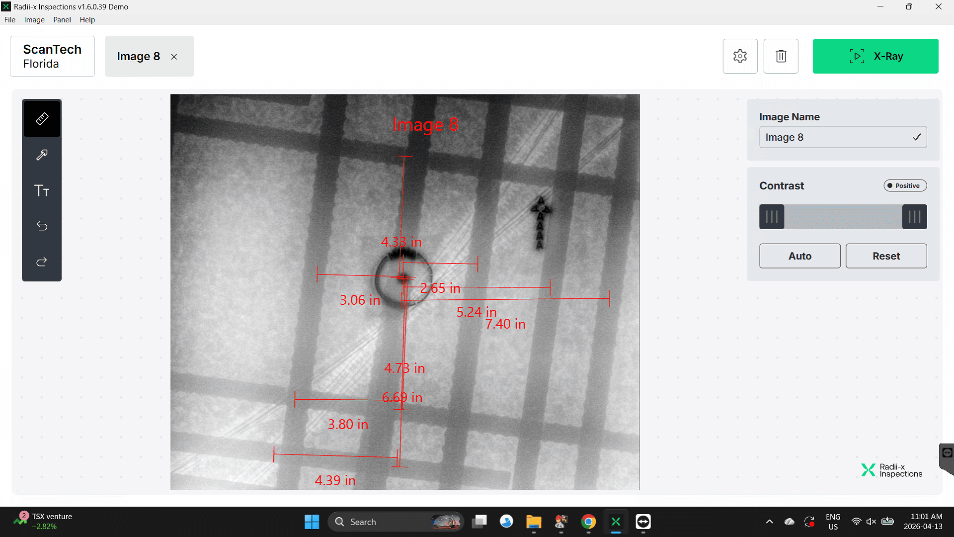 Online meaurments after Digital X-Ray with Radii-x Software