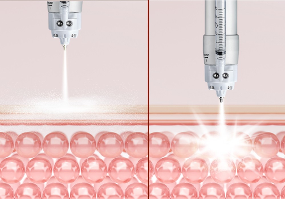 curejet device treatment 