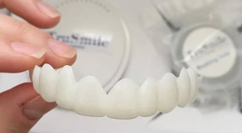 Flex TruSmile Veneers