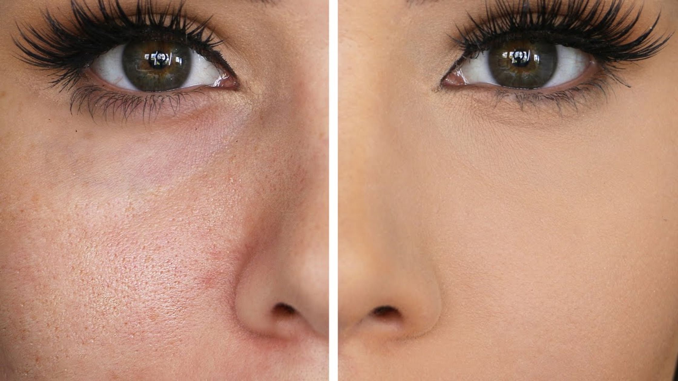 Shrink Large Pores with Facial