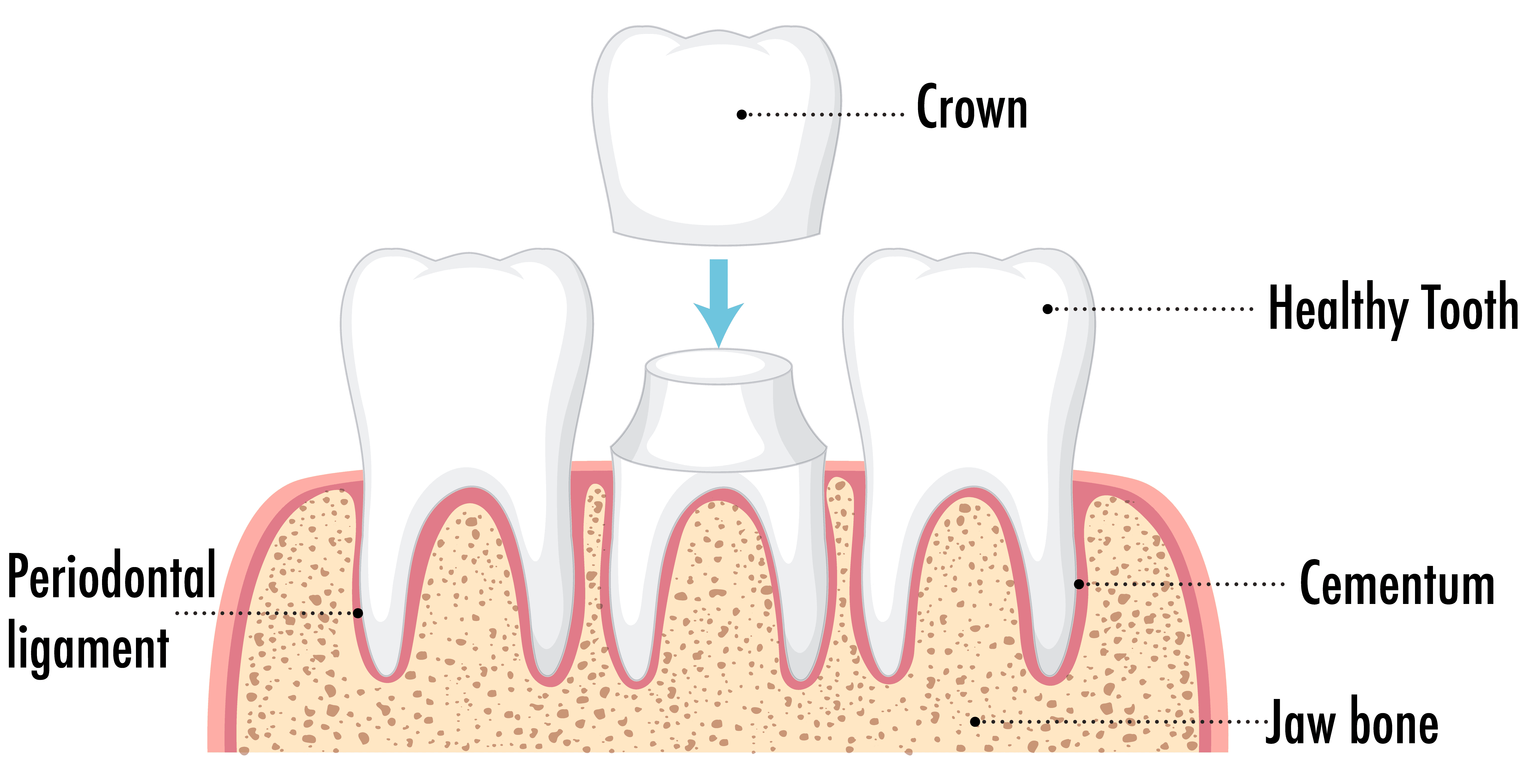 Cari-Vu Dental Cavity Scanner at Sovrle Dental in North York