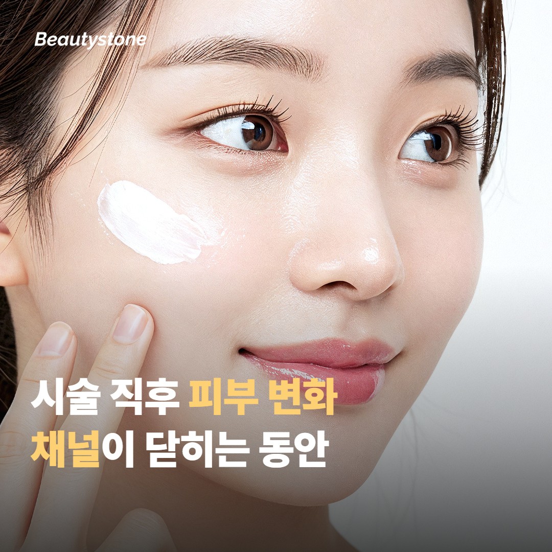 시술 직후 피부에서 일어나는 변화