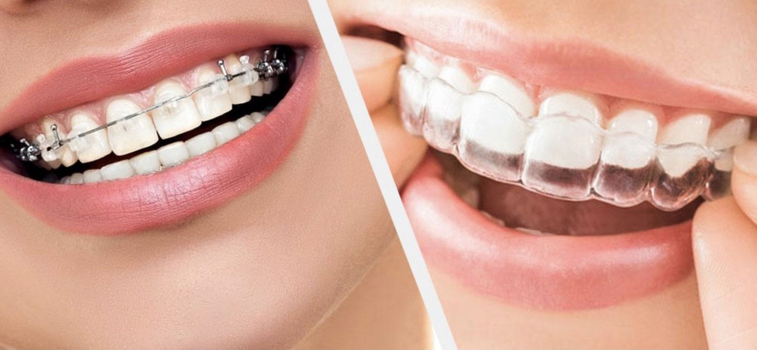 orthodontics in smyrna
