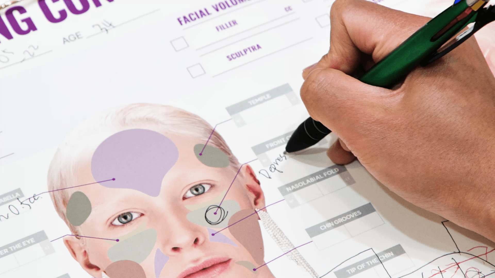 울써마지 초음파 에너지가 피부 근막층에 전달되는 원리 설명 이미지