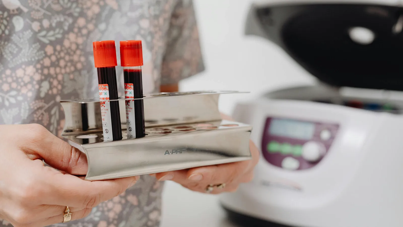 What Is Alkaline Phosphatase?