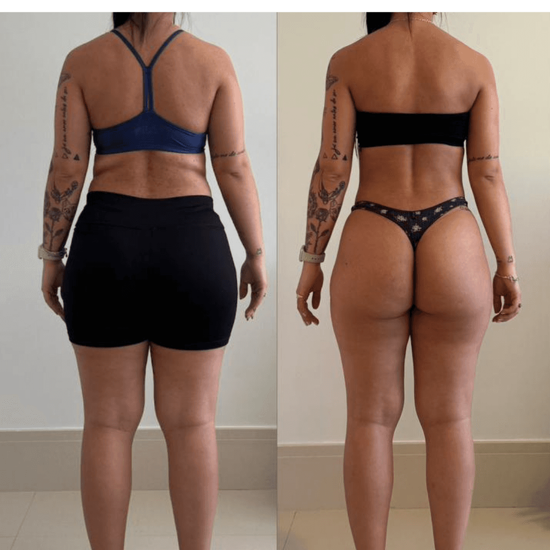 Transformation Photo