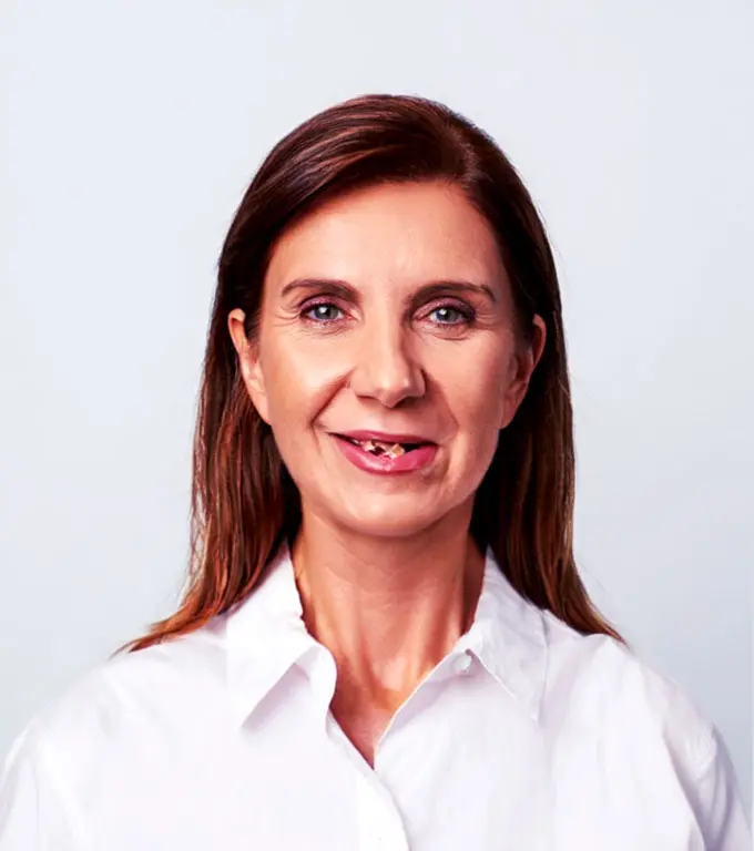 Woman with missing teeth smiling, showing dental problem.