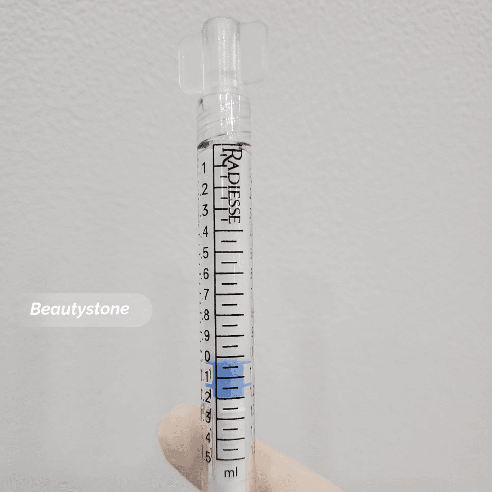 레디어스 필러와 히알루론산 필러 관자 시술 비교