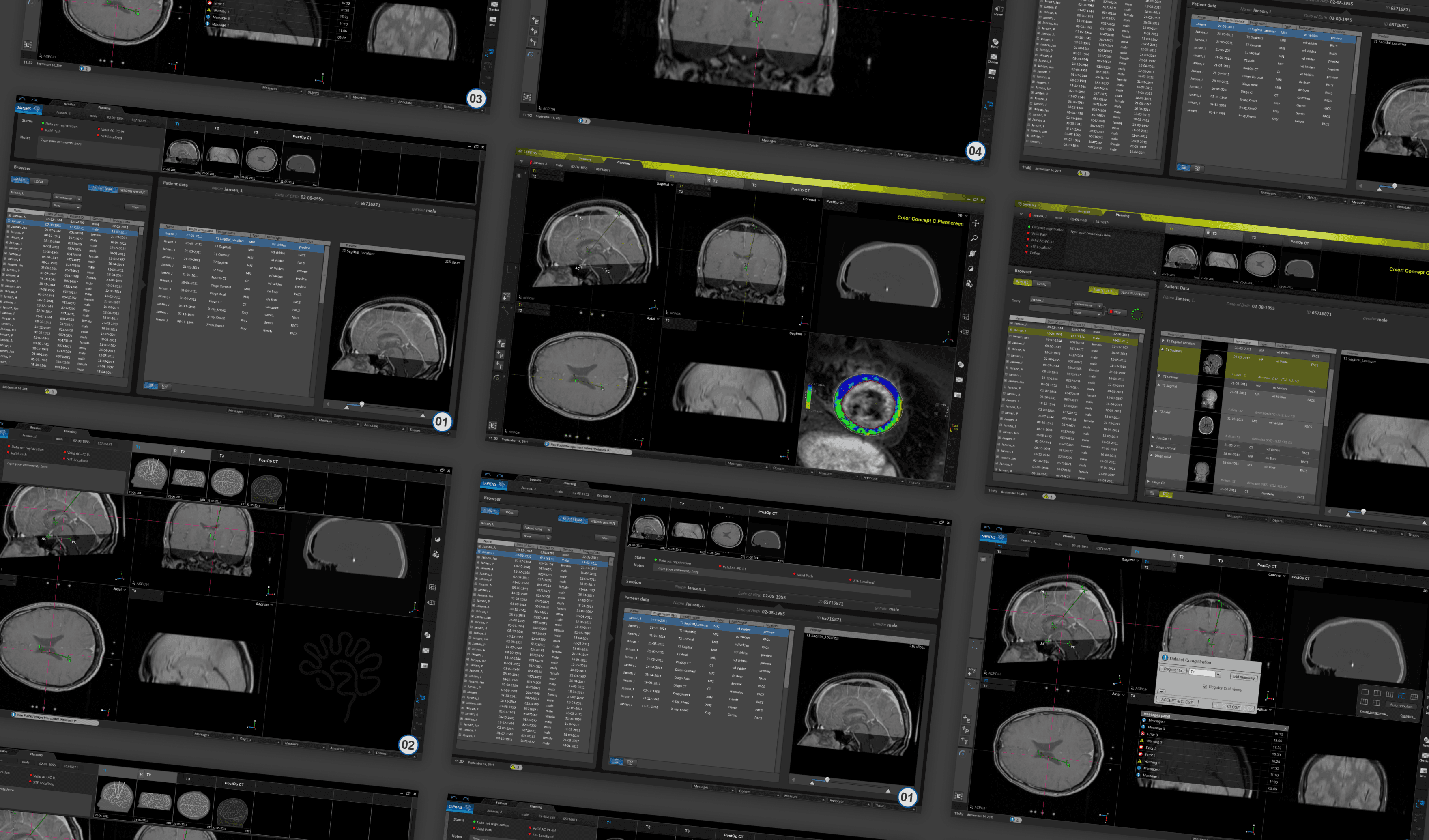 Image of UX Design of MRI software suite for Sapiens - Medtronic