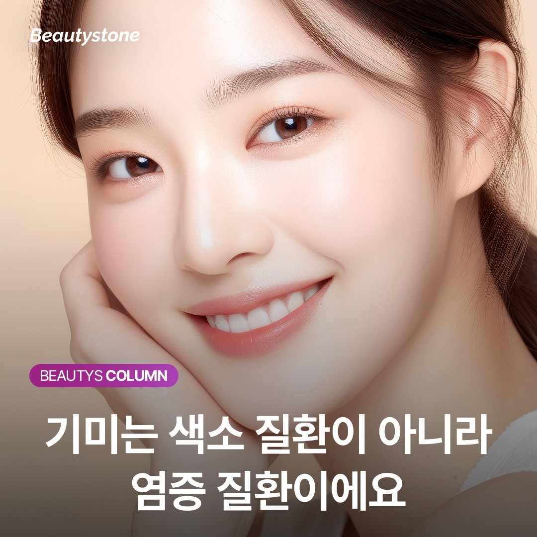 기미는 색소 질환이 아니라 '염증 질환'입니다: 치료 방향이 바뀌어야 하는 이유