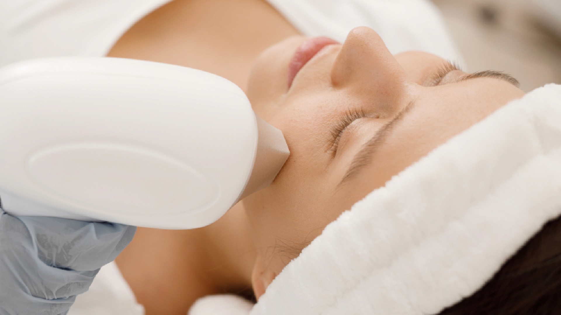 Laser treatment for pigmentation in Singapore.