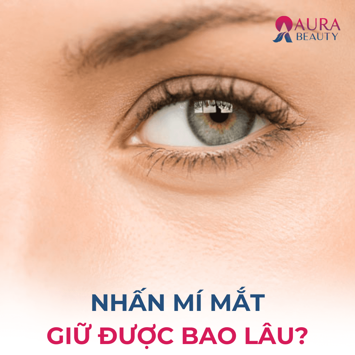 Nhấn mí mắt giữ được bao lâu