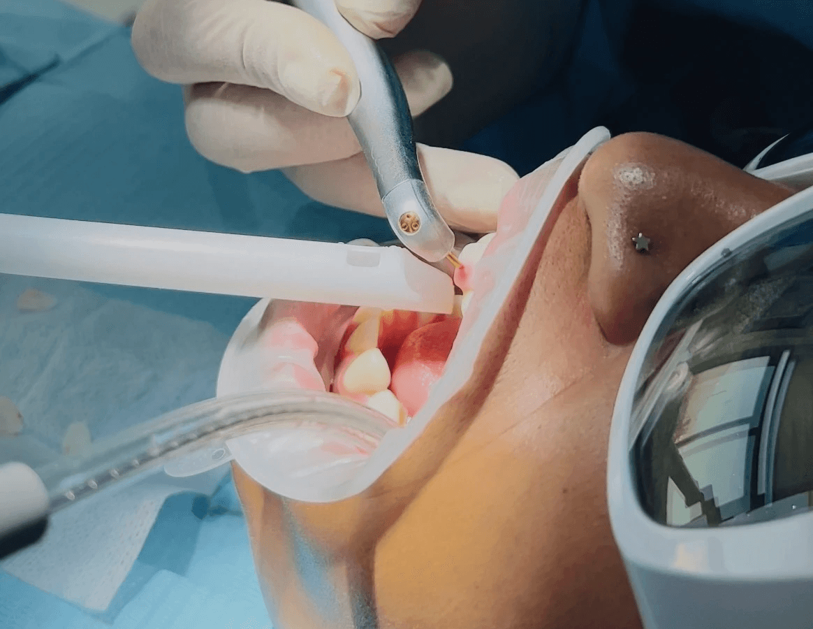 Professional periodontal treatment for managing gum disease and preventing progression