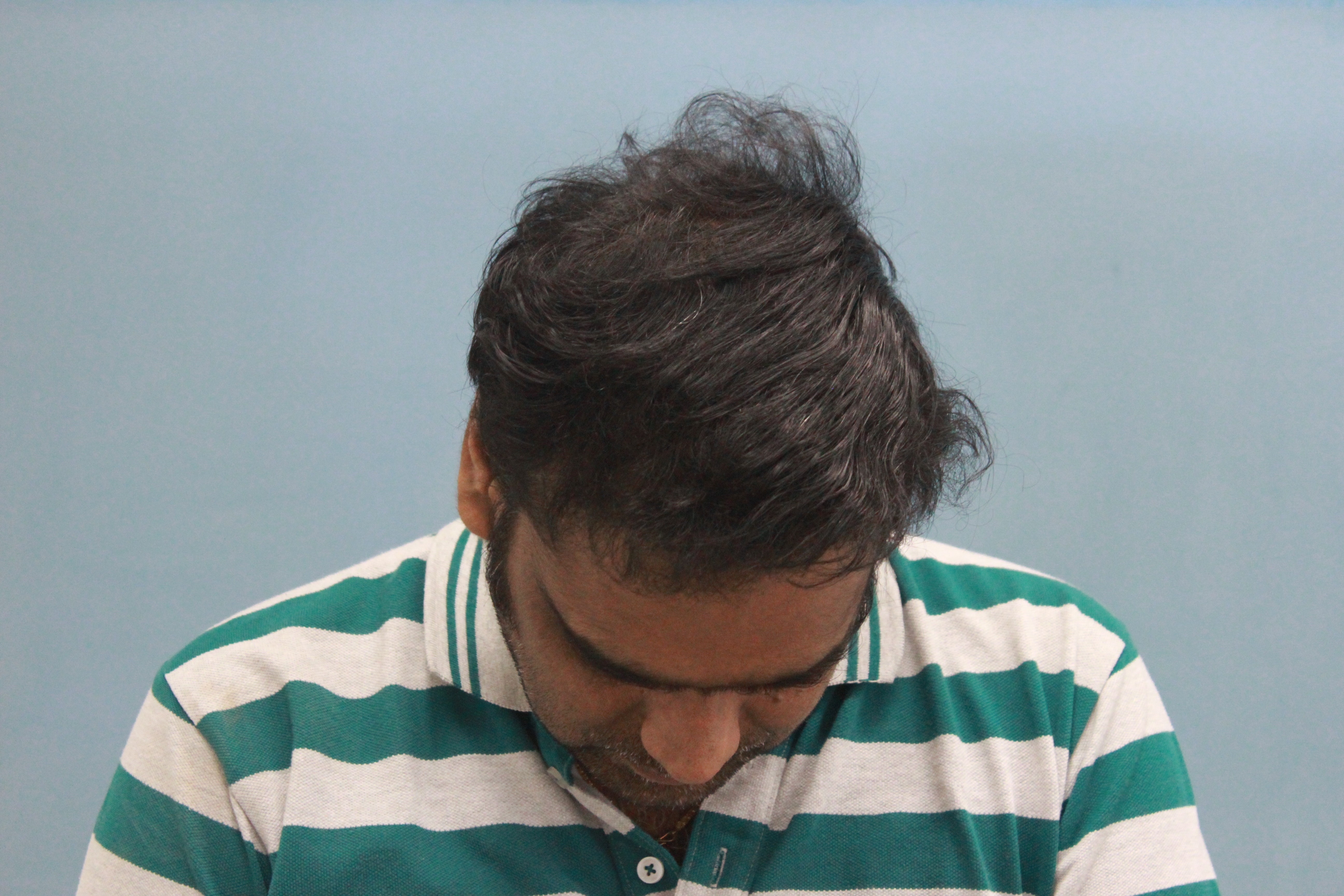 Close-up of freckled face with rose and glossy lips