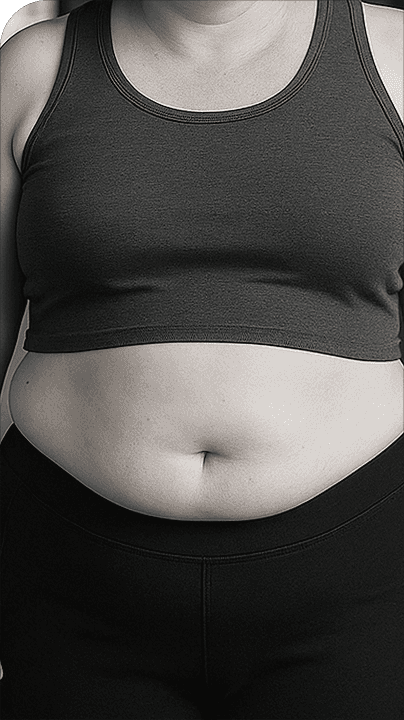 before-weight-loss
