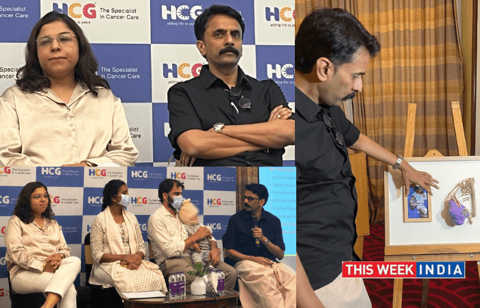 Miracle in Bengaluru: HCG Cancer Centre Performs Pioneering Life-Saving Surgery on 28-Day-Old Infant with Rare, Massive Fibrosarcoma