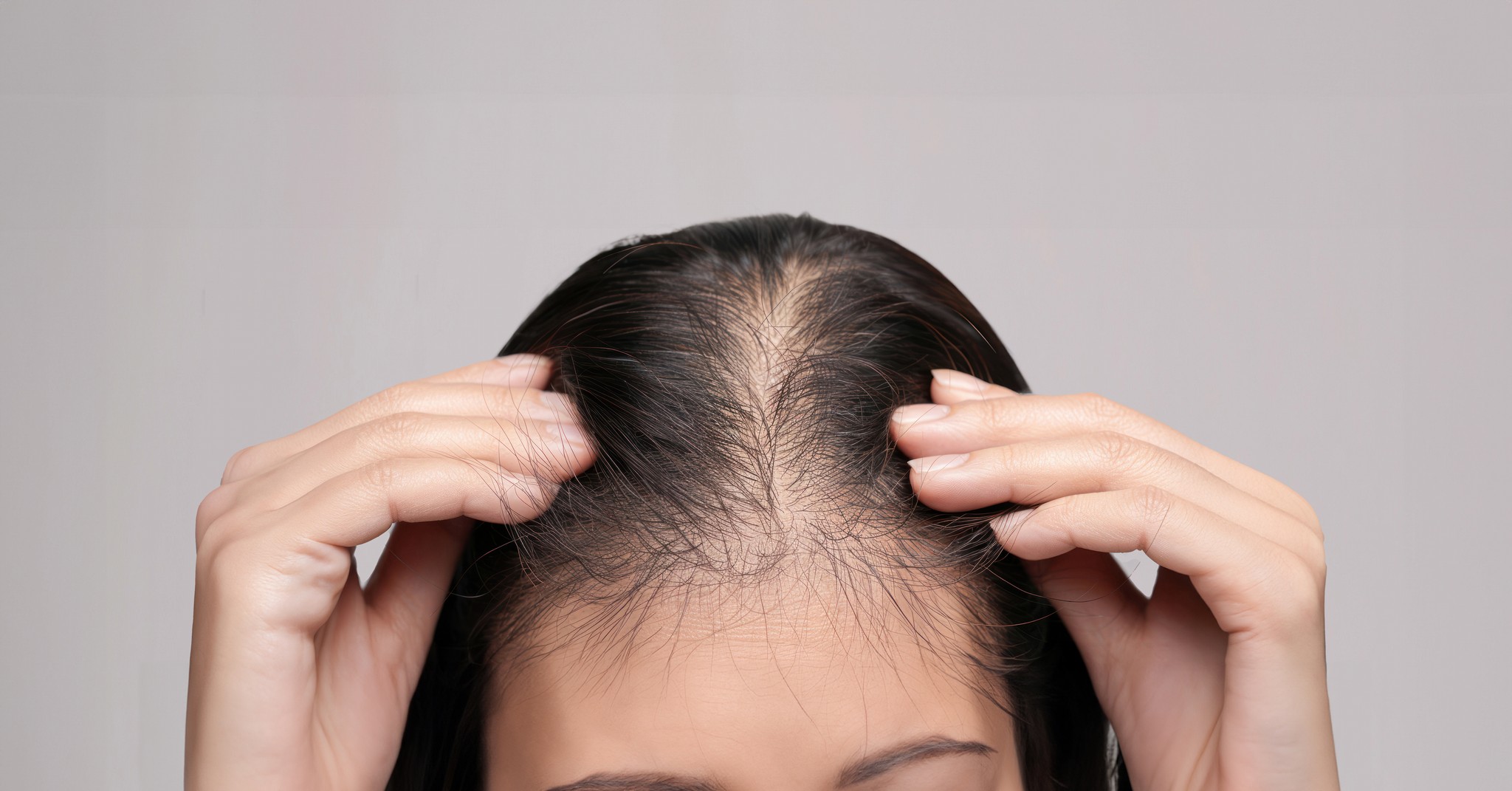 Women's Hair Loss